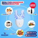 KIT BLANQUEAMIENTO DENTAL EN CASA